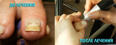 Скобы для ногтей своими руками Скобы для ногтей своими руками